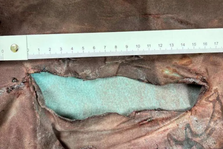 Man knivhöggs svårt i Götene – båda inblandade frias